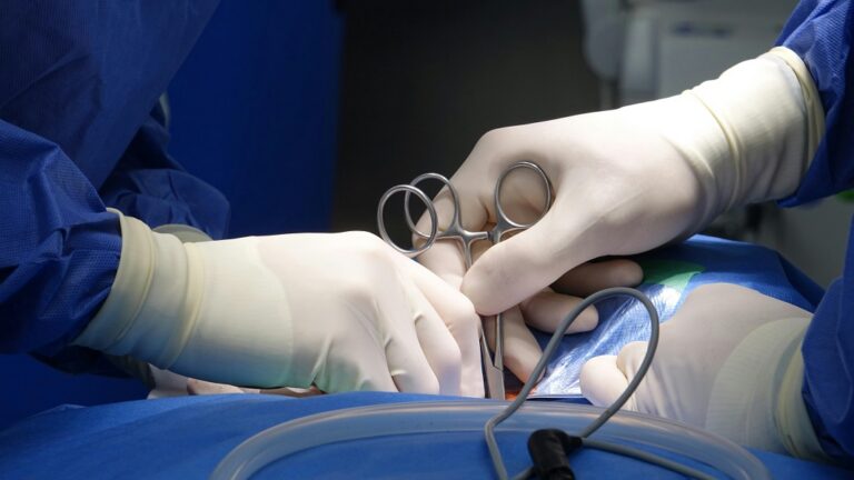 How Much Is A Herniated Disc Worth?