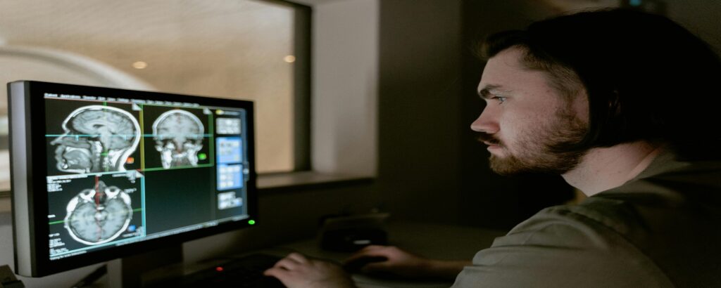 Picture of radiologist reviewing study of brain associated with blog on seeing brain injury